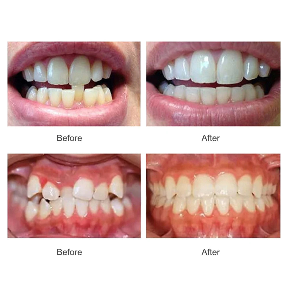 Orthodontic Braces
 Dental Braces
 Smile Teeth Alignment