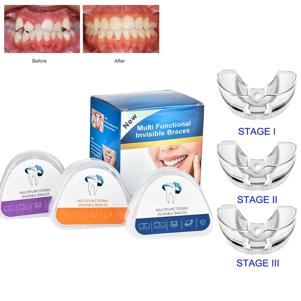 Orthodontic Braces
 Dental Braces
 Smile Teeth Alignment